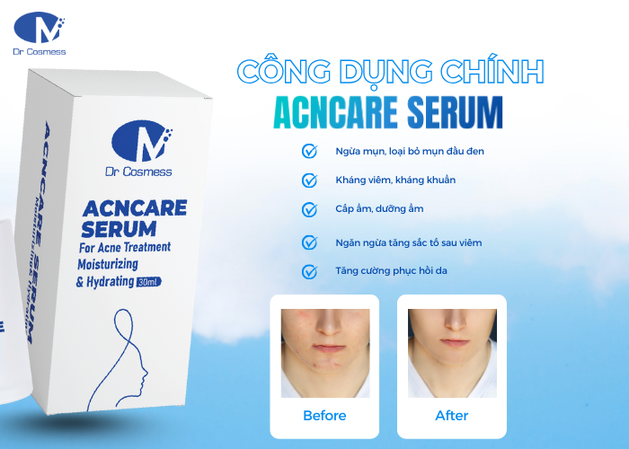 Công dụng chính Serum mụn Acncare Serum