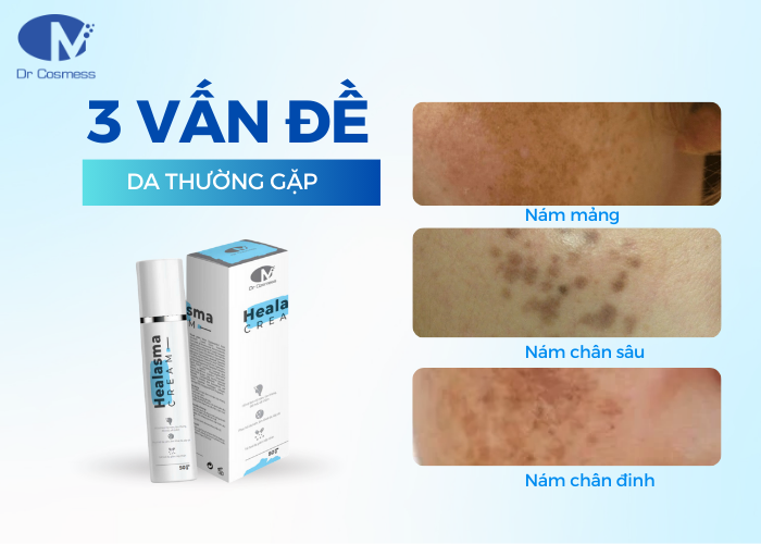 Hướng dẫn sử dụng kem nám Healasma Cream của Dr Cosmess