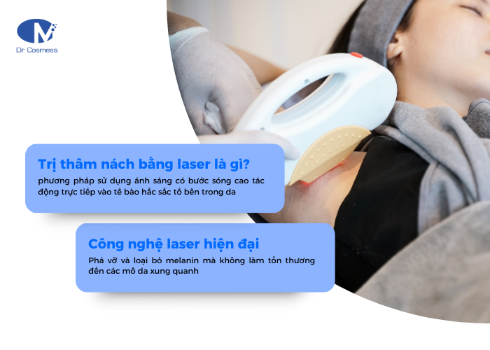 Phương pháp trị thâm nách bằng laser là gì?