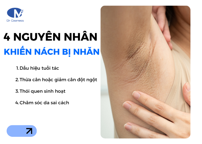 4 nguyên nhân khiến nách bị nhăn