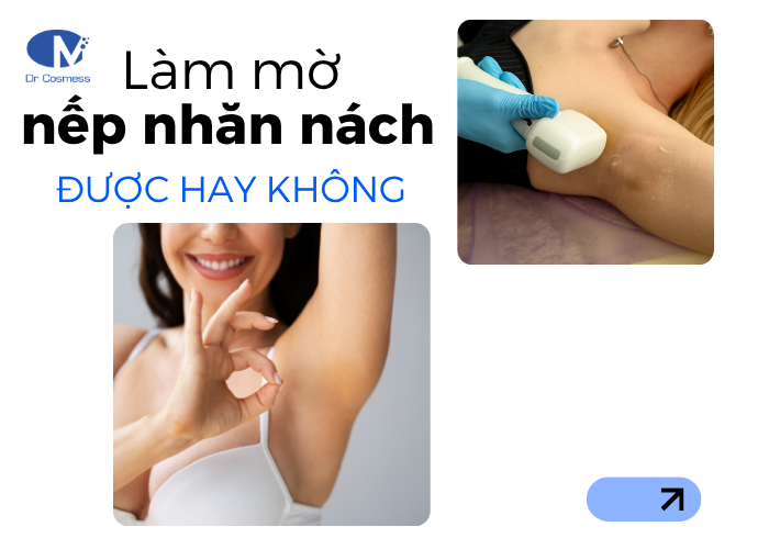 Có làm mờ nếp nhăn nách được không?