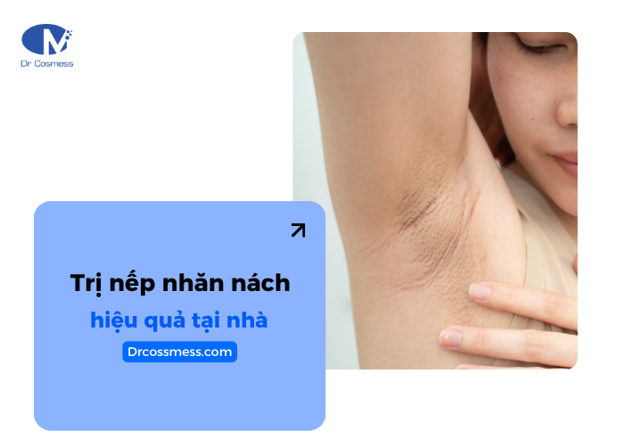 Cách trị nếp nhăn ở nách hiệu quả tại nhà