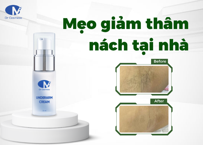 Kem trị thâm nách hiệu quả nhanh