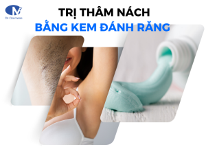 Trị thâm nách bằng kem đánh răng