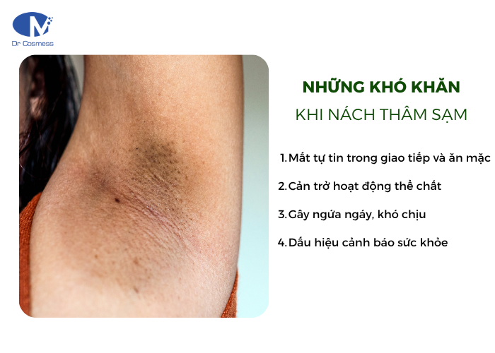 Những khó khăn khi vùng da dưới cánh tay bị thâm