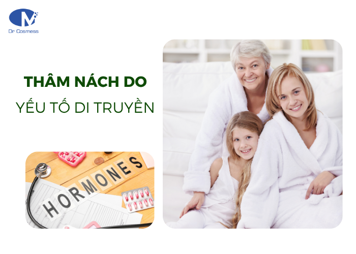 Vùng da dưới cánh tay sậm màu do yếu tố di truyền