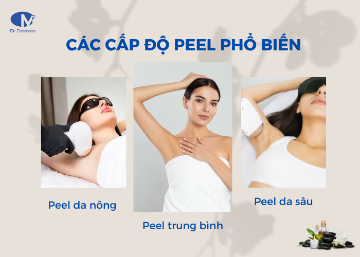 Các mức độ peel phổ biến hiện nay
