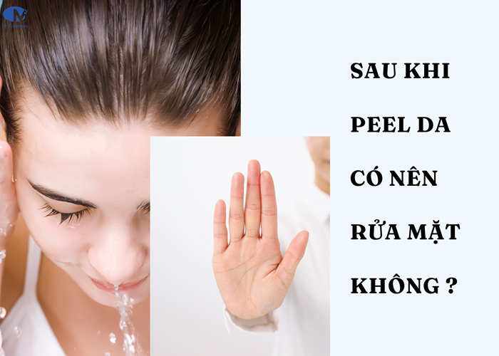 Sau peel bạn không nên rửa mặt ngay mà chỉ thấm nước để vệ sinh da