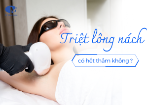 Triệt lông nách có hết thâm không?