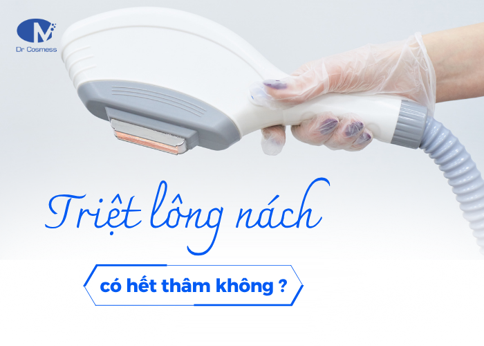 Triệt lông nách không giúp hết thâm nhưng ?