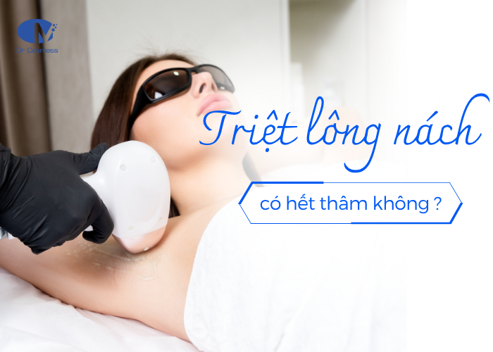 Triệt lông nách có hết thâm không?