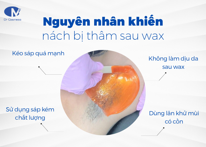 Wax lông nách khiến nách bị thâm sau Wax
