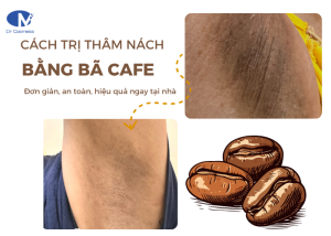 Cách trị thâm nách bằng bã cà phê đơn giản, an toàn