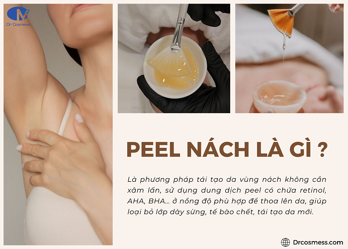 Phương pháp peel nách là như thế nào?