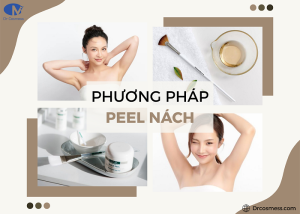Peel da nách bao lâu thì bong?