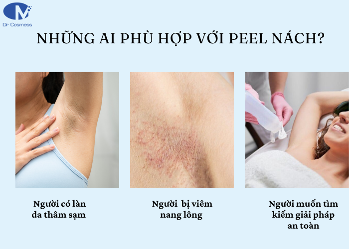 Đối tượng phù hợp với peel nách?