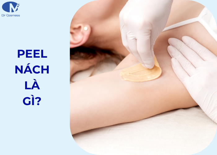 Phương pháp peel nách là gì?