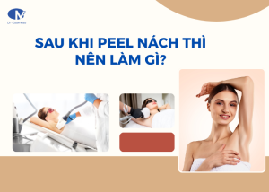 Sau khi peel nách cần làm gì để thúc đẩy nhanh quá trình phục hồi?